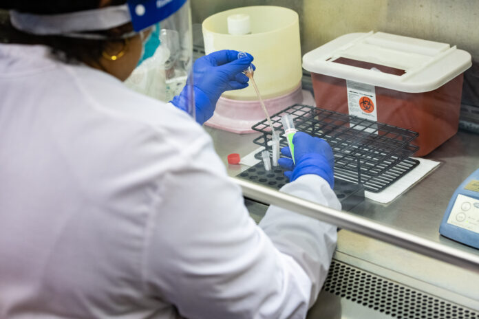 Covid-19 lab test Stanford Medicine